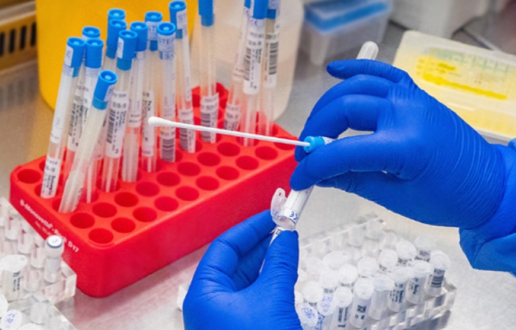 718 са новите случаи на коронавирус у нас за последните